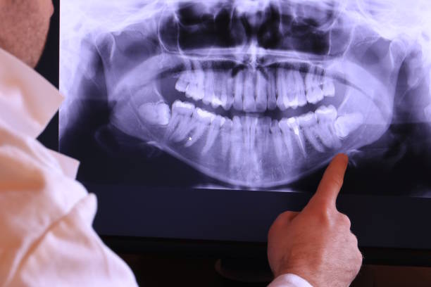 Best Emergency TMJ Treatment in West Point, GA