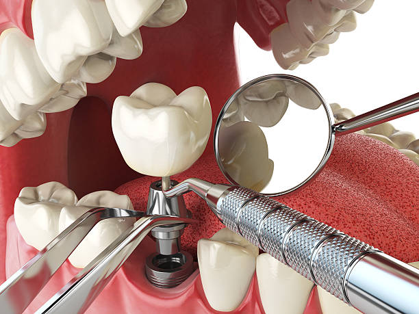 Best Cosmetic Emergency Dentistry in West Point, GA